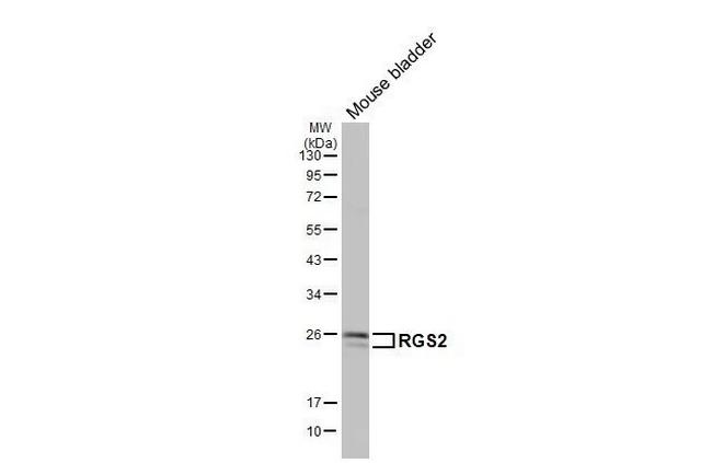RGS2 Antibody in Western Blot (WB)