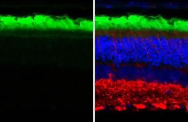 Rhodopsin Antibody in Immunohistochemistry (Paraffin) (IHC (P))
