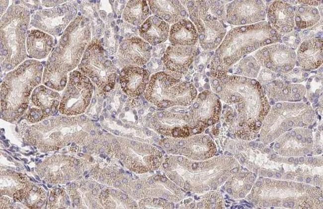 ROBO1 Antibody in Immunohistochemistry (Paraffin) (IHC (P))
