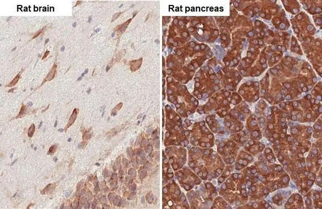 RPL4 Antibody in Immunohistochemistry (Paraffin) (IHC (P))