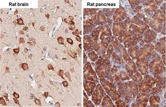 RPL4 Antibody in Immunohistochemistry (Paraffin) (IHC (P))