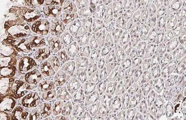 SCAP Antibody in Immunohistochemistry (Paraffin) (IHC (P))