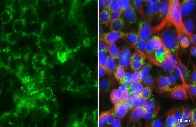 DHCR24 Antibody in Immunocytochemistry (ICC/IF)