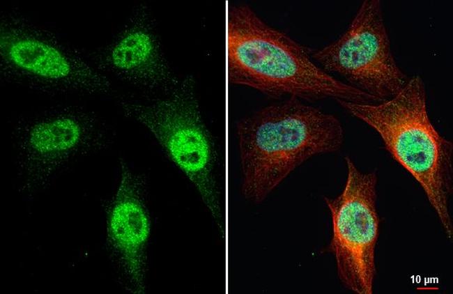 SETD1A Antibody in Immunocytochemistry (ICC/IF)