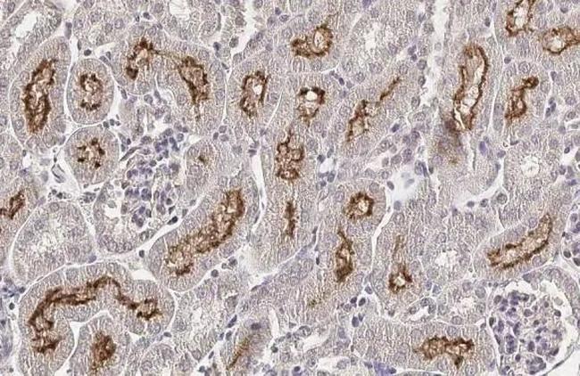SLC5A8 Antibody in Immunohistochemistry (Paraffin) (IHC (P))