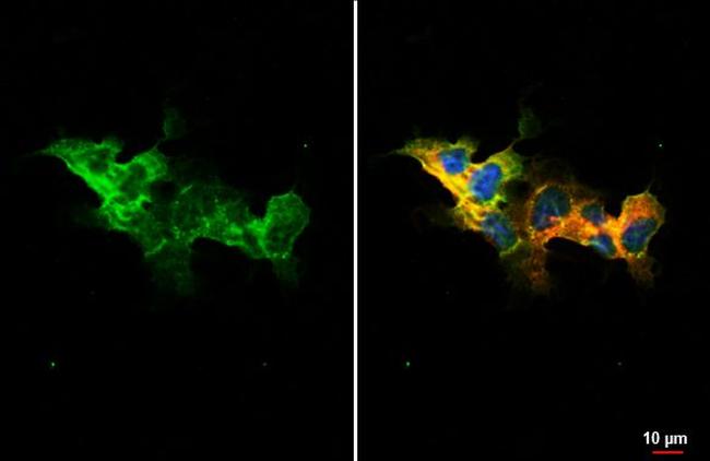 SMO Antibody in Immunocytochemistry (ICC/IF)