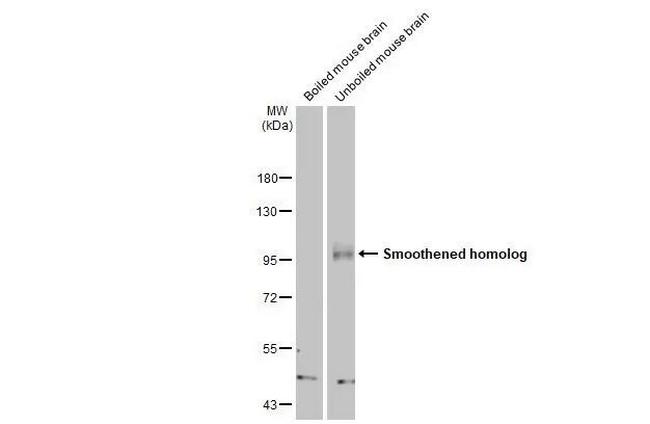 SMO Antibody in Western Blot (WB)