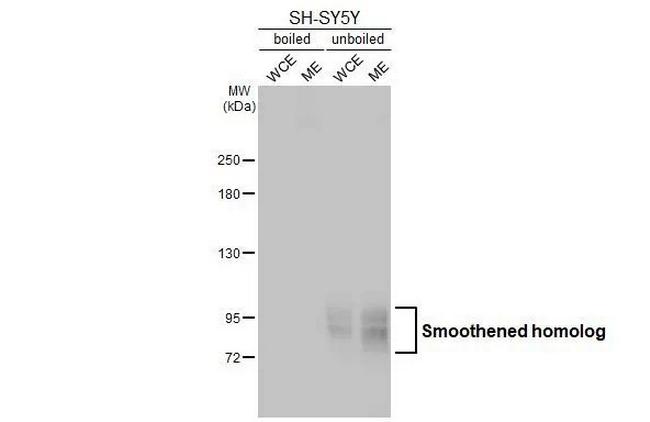 SMO Antibody in Western Blot (WB)