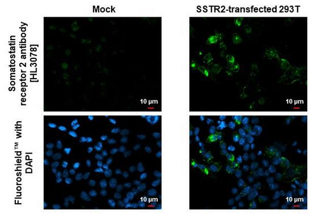 SSTR2 Antibody in Immunocytochemistry (ICC/IF)