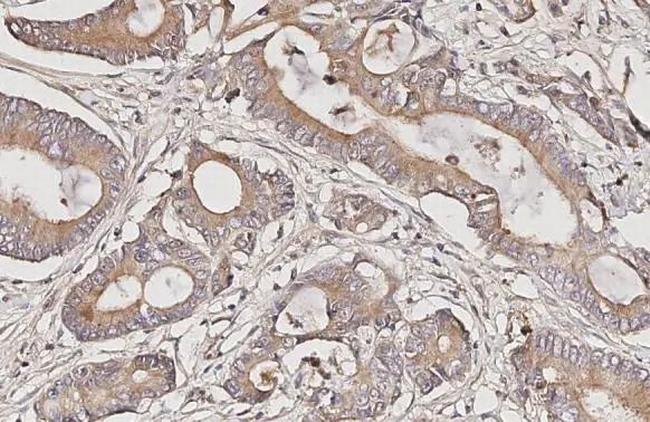SSTR4 Antibody in Immunohistochemistry (Paraffin) (IHC (P))