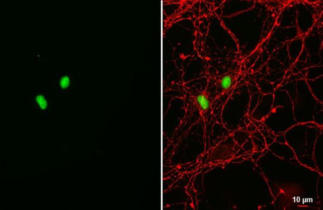 SOX2 Antibody in Immunocytochemistry (ICC/IF)