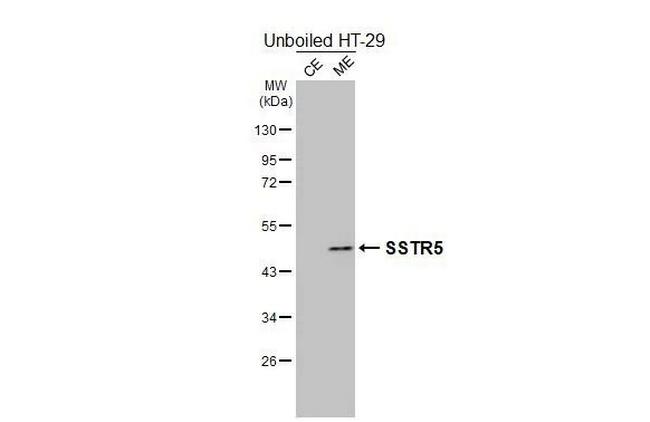 SSTR5 Antibody in Western Blot (WB)