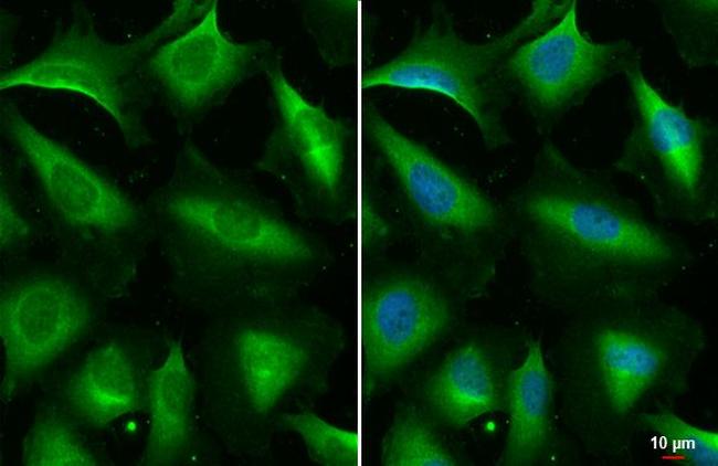 STAM Antibody in Immunocytochemistry (ICC/IF)