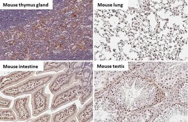STAT3 Antibody in Immunohistochemistry (Paraffin) (IHC (P))