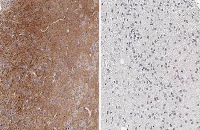 Phospho-Tau (Thr181) Antibody in Immunohistochemistry (Paraffin) (IHC (P))