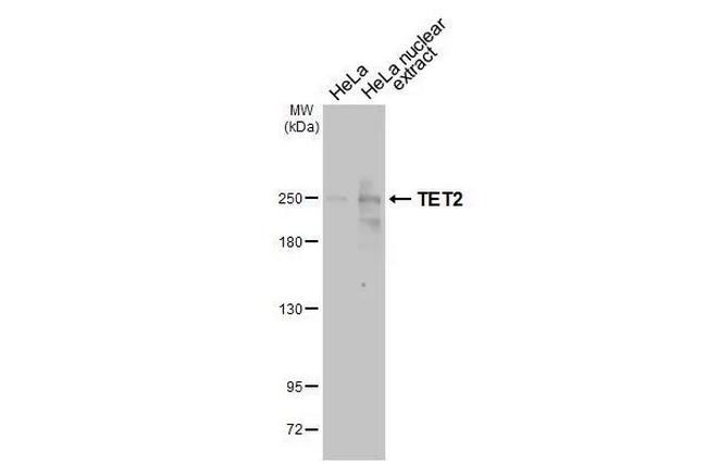 TET2 Antibody in Western Blot (WB)