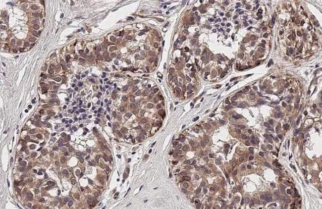 TIGIT Antibody in Immunohistochemistry (Paraffin) (IHC (P))