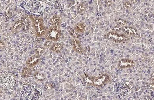 TMPRSS2 Antibody in Immunohistochemistry (Paraffin) (IHC (P))