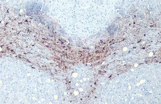 Tyrosine Hydroxylase Antibody in Immunohistochemistry (Paraffin) (IHC (P))