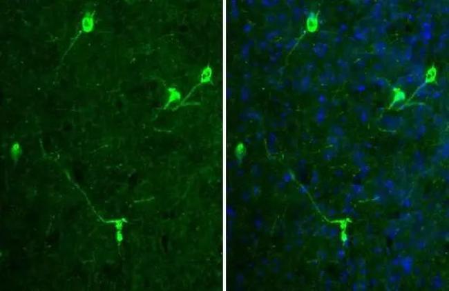 Tyrosine Hydroxylase Antibody in Immunohistochemistry (Frozen) (IHC (F))
