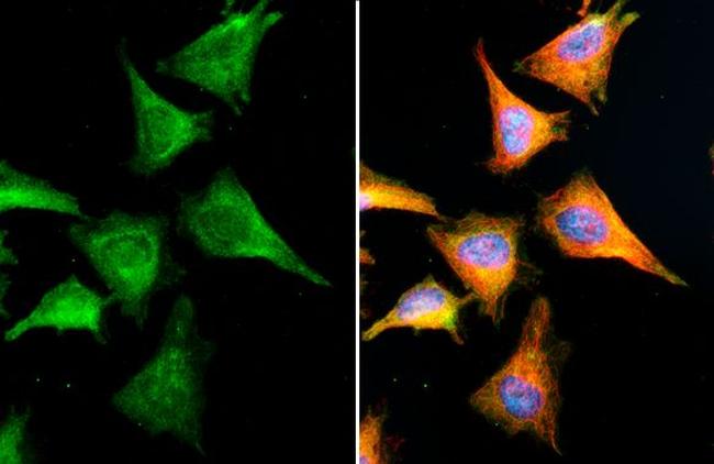 VCP Antibody in Immunocytochemistry (ICC/IF)