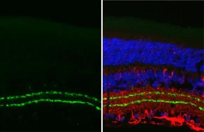 VAChT Antibody in Immunohistochemistry (Paraffin) (IHC (P))