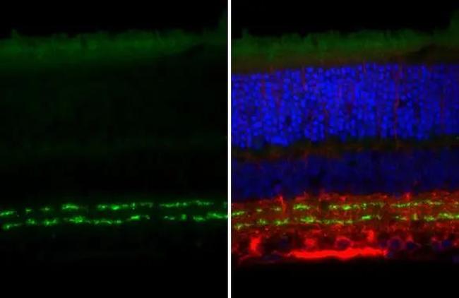VAChT Antibody in Immunohistochemistry (Paraffin) (IHC (P))