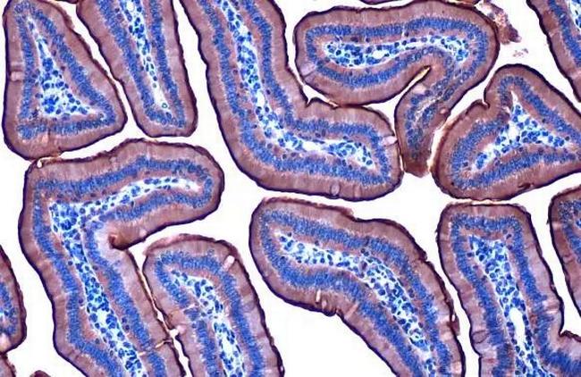 Villin Antibody in Immunohistochemistry (Paraffin) (IHC (P))
