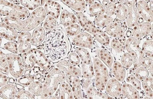 XPC Antibody in Immunohistochemistry (Paraffin) (IHC (P))