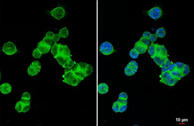 XPR1 Antibody in Immunocytochemistry (ICC/IF)