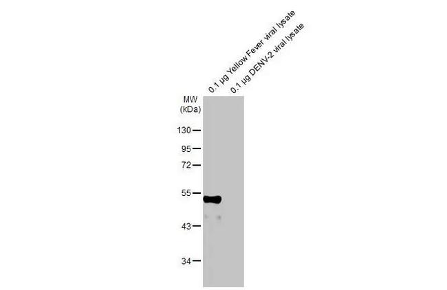 Yellow Fever Virus Envelope Protein (strain 17D vaccine) Antibody in Western Blot (WB)