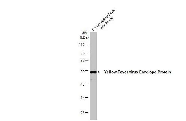 Yellow Fever Virus Envelope Protein (strain 17D vaccine) Antibody in Western Blot (WB)