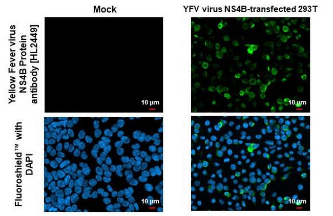 Yellow Fever Virus NS4B (strain 17D vaccine) Antibody in Immunocytochemistry (ICC/IF)