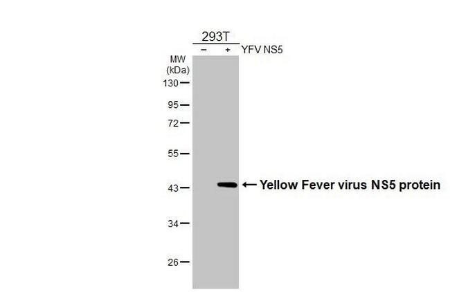 Yellow Fever Virus NS5 (strain 17D vaccine) Antibody in Western Blot (WB)