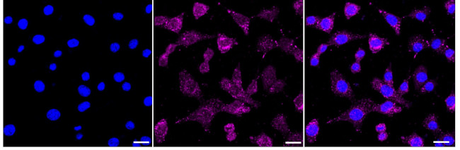 Ly-6A/E Antibody in Immunocytochemistry (ICC/IF)