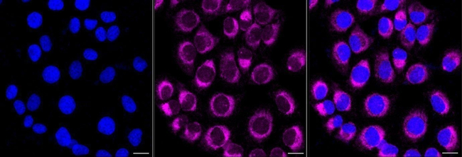 PTP1B/PTPN2 Antibody in Immunocytochemistry (ICC/IF)