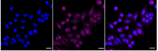 ACACB Antibody in Immunocytochemistry (ICC/IF)