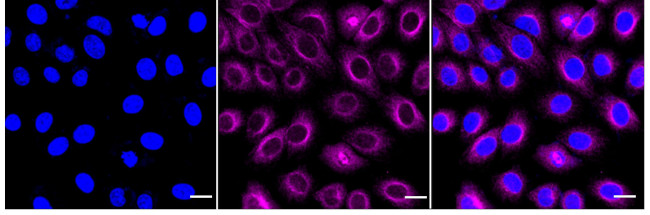 ADH4 Antibody in Immunocytochemistry (ICC/IF)
