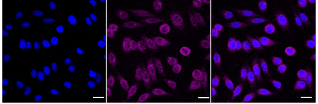 ADH5 Antibody in Immunocytochemistry (ICC/IF)