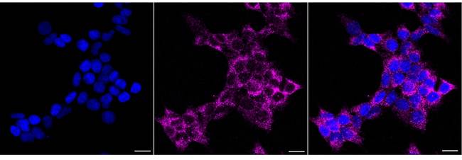 AGPS Antibody in Immunocytochemistry (ICC/IF)