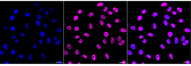 ALAS2 Antibody in Immunocytochemistry (ICC/IF)