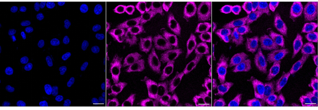 ALKBH2 Antibody in Immunocytochemistry (ICC/IF)
