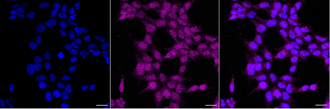 ALKBH4 Antibody in Immunocytochemistry (ICC/IF)