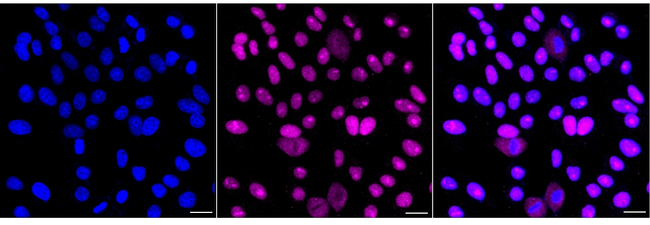 Aprataxin Antibody in Immunocytochemistry (ICC/IF)