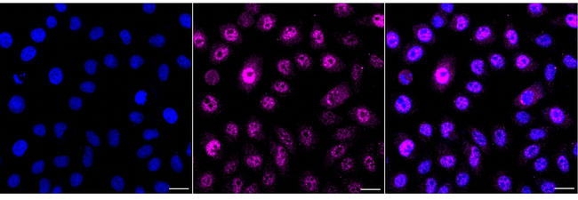 Aquaporin 2 Antibody in Immunocytochemistry (ICC/IF)