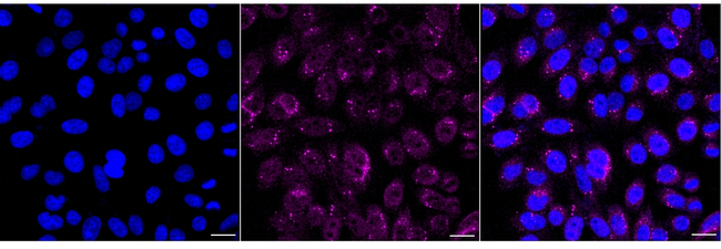 ATF6 Antibody in Immunocytochemistry (ICC/IF)