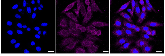 PMCA1 ATPase Antibody in Immunocytochemistry (ICC/IF)