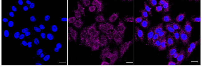 ATP5G1 Antibody in Immunocytochemistry (ICC/IF)