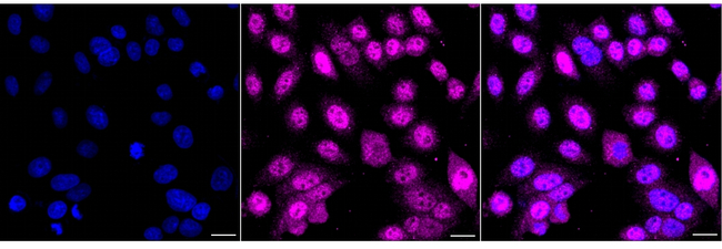 ATP6V0D1 Antibody in Immunocytochemistry (ICC/IF)