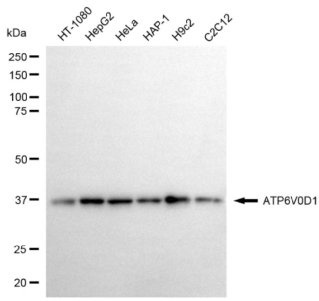 ATP6V0D1 Antibody in Western Blot (WB)